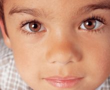 Signs Your Child Might Have a Lazy Eye