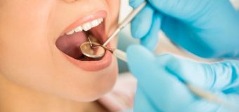 Dental Plans For Excellent Dental Hygiene