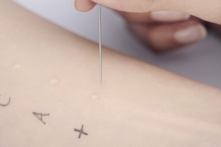 What Are Food Allergy Tests