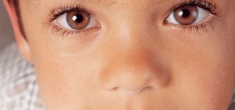 Signs Your Child Might Have a Lazy Eye