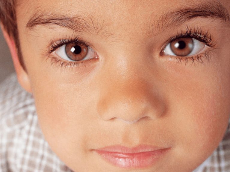 Signs Your Child Might Have a Lazy Eye