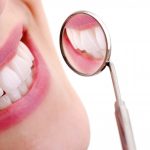 Important Facts about Dental Crowns