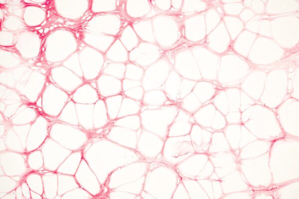 Close-up view of stained tissue cells